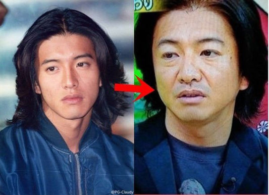 ํผ๋ถ ๋
ธํ๋ฅผ ๊ฐ์ฅ ์ ๋ ดํ ๊ฐ๊ฒฉ์ผ๋ก, ๊ฐ์ฅ ํจ๊ณผ์ ์ผ๋ก ๋ฆ์ถ ์ ์๋ ๋ฐฉ๋ฒ - ์์ธ์  ์ฐจ๋จ์  (1)