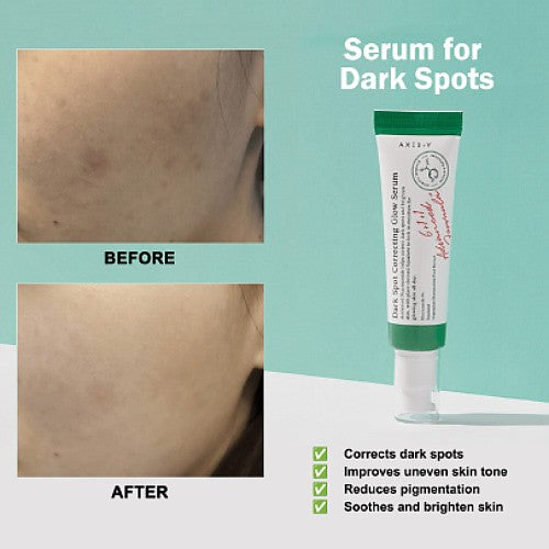 AXIS-Y Dark Spot Correcting Glow Serum 50ml ์์์ค์์ด ์กํฐ์ผ์ด ๊ธ๋ก์ฐ ์ธ๋ผ 50ml