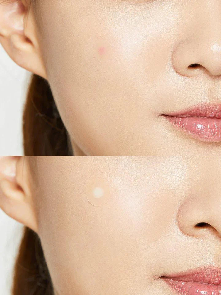 COSRX Acne Pimple Master Patch 코스알엑스 아크네 핌플 마스터 패치
