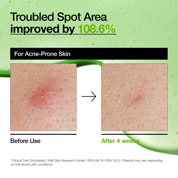Anua Azelaic Acid 100 Hyaluron Redness Soothing Serum 1.01 fl. oz. / 30ml