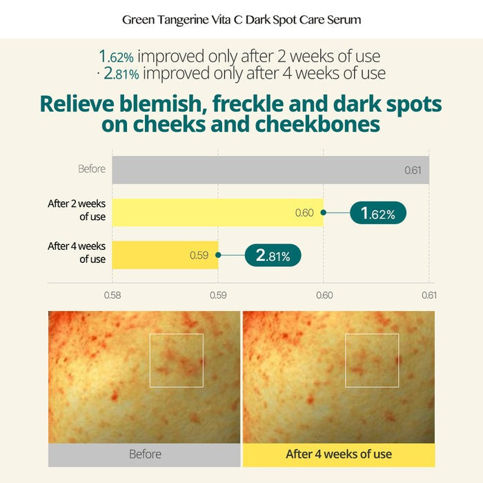 GOODAL GREEN TANGERINE VITA C DARK SPOT CARE SERUM 40ml 구달 청귤 비타씨 잡티 케어 세럼 40ml