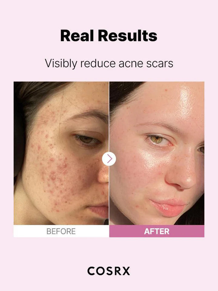 COSRX The Niacinamide 15 Serum 20mL / 0.67 fl.oz. 코스알엑스 더 나이아신아마이드 15 세럼 20ml / 0.67 fl.oz.