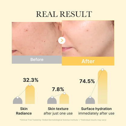 Medicube Kojic Acid Tumeric Brightening Gel Mask 28g / 0.98 oz. x 4ea 메디큐브 코직애씨드 터메릭 비타 겔 마스크 28g / 0.98 oz. x 4ea