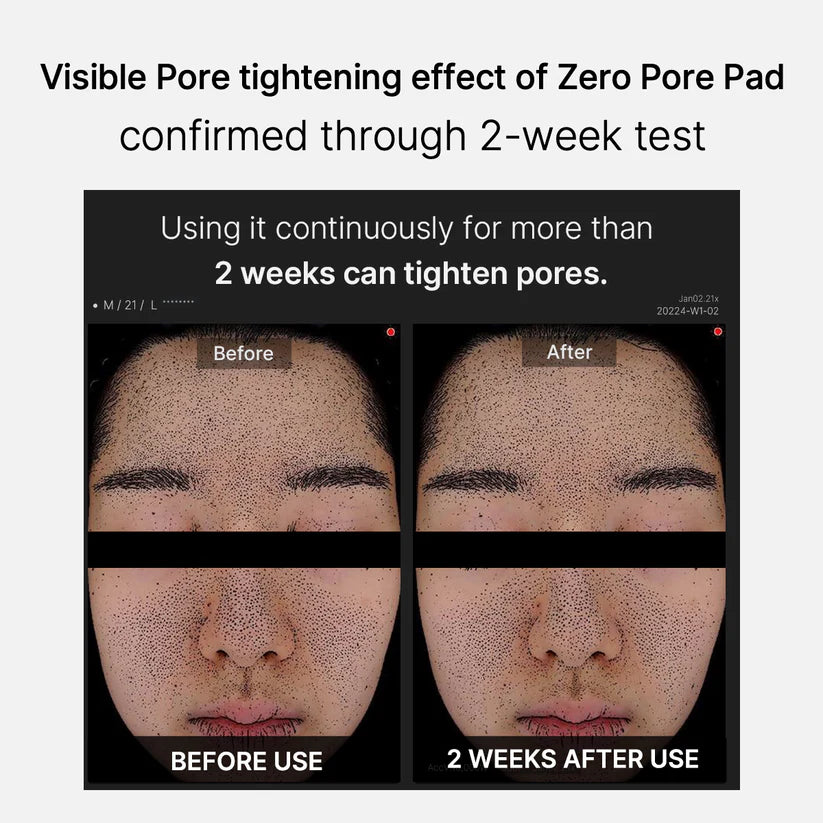 Medicube Zero Pore Pad 2.0 메디큐브 제로모공패드 2.0