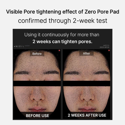 Medicube Zero Pore Pad 2.0 메디큐브 제로모공패드 2.0