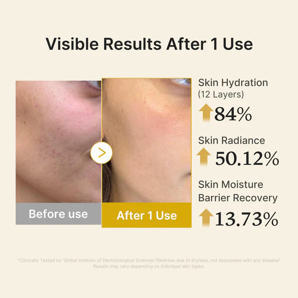 Medicube Kojic Acid Turmeric Vitamin Gold Jelly Mist Serum 100ml 메디큐브 코직애씨드 터메릭 비타 미스트 세럼 100ml
