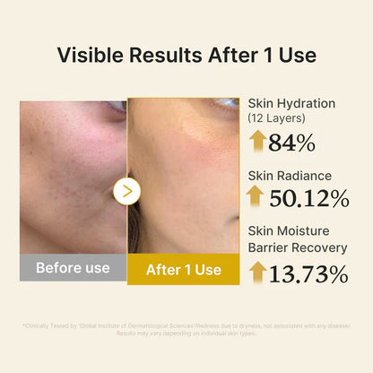 Medicube Kojic Acid Turmeric Vitamin Gold Jelly Mist Serum 100ml 메디큐브 코직애씨드 터메릭 비타 미스트 세럼 100ml