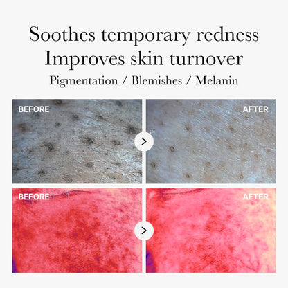 Medicube Red Succinic Acid Panthenol Pads 메디큐브 레드 석시닉 애씨드 패드 트러블개선