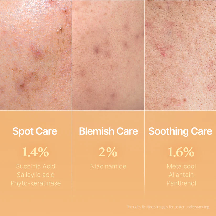 Medicube Red Succinic Acid Panthenol Pads 메디큐브 레드 석시닉 애씨드 패드 트러블개선