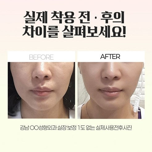 SNL 스마일 클리닉 PICK** DH Medicare Dr. Lifting Band DH 메디케어 닥터 리프팅 밴드