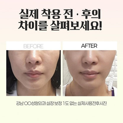 SNL 스마일 클리닉 PICK** DH Medicare Dr. Lifting Band DH 메디케어 닥터 리프팅 밴드