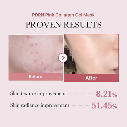 Medicube Salmon PDRN Pink Collagen Jelly Gel Mask 4EA 메디큐브 PDRN 핑크 콜라겐 겔 마스크 4매입