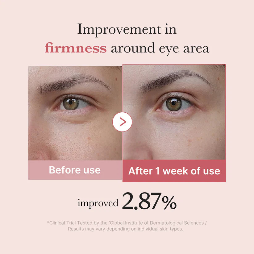 Medicube PDRN Pink Peptide Eye Cream 30ml 메디큐브 PDRN 핑크 펩타이드 아이크림 30ml