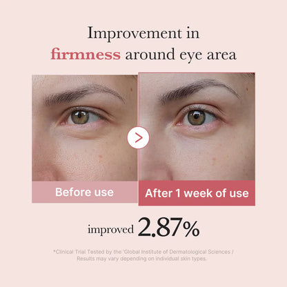 Medicube PDRN Pink Peptide Eye Cream 30ml 메디큐브 PDRN 핑크 펩타이드 아이크림 30ml