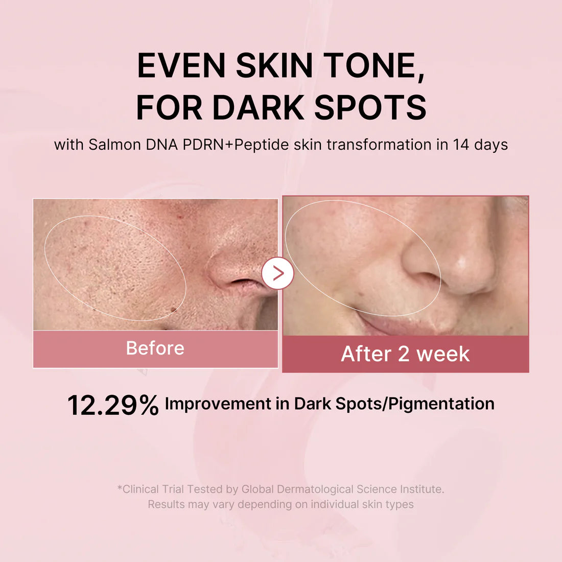 Medicube PDRN Pink Peptide Toner 250ml 메디큐브 PDRN 핑크 시카 수딩 토너 250ml